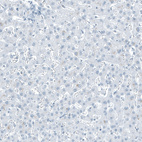 Anti-SLC22A8 Antibody