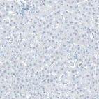 Immunohistochemical staining of human Liver shows no positivity in hepatocytes as expected.