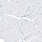Immunohistochemical staining of human Skeletal muscle shows no positivity in myocytes as expected.