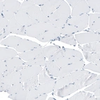 Immunohistochemical staining of human Skeletal muscle shows no positivity in myocytes as expected.