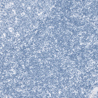 Immunohistochemical staining of human Tonsil shows no positivity in non-germinal center cells as expected.