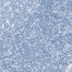 Immunohistochemical staining of human Tonsil shows no positivity in non-germinal center cells as expected.