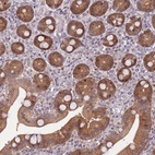 Anti-ARHGEF5 Antibody
