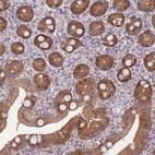 Anti-ARHGEF5 Antibody