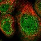 Immunofluorescent staining of human cell line A-431 shows localization to nucleoplasm & vesicles.