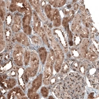 Immunohistochemical staining of human kidney shows moderate nuclear positivity in cells in tubules.