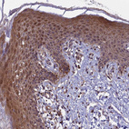 Anti-COMMD2 Antibody