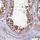 Immunohistochemical staining of human testis shows strong nuclear positivity in cells in seminiferous ducts.