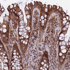 Immunohistochemical staining of human rectum shows strong cytoplasmic positivity in glandular cells.
