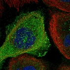 Immunofluorescent staining of human cell line A-431 shows localization to plasma membrane & cytosol.