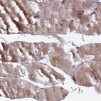 Immunohistochemical staining of human skeletal muscle shows moderate cytoplasmic positivity in myocytes.