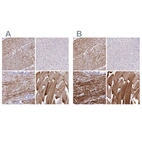 Immunohistochemical staining of human heart muscle, liver, prostate and skeletal muscle using Anti-SYNM antibody HPA044200 (A) shows similar protein distribution across tissues to independent antibody HPA040066 (B).
