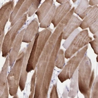 Immunohistochemical staining of human skeletal muscle shows strong cytoplasmic positivity in myocytes.