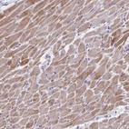 Immunohistochemical staining of human heart muscle shows strong cytoplasmic positivity in cardiomyocytes.
