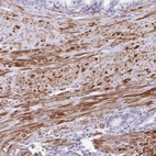 Immunohistochemical staining of human prostate shows strong cytoplasmic positivity in smooth muscle cells.