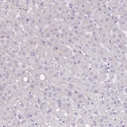 Immunohistochemical staining of human liver shows no cytoplasmic positivity in hepatocytes.