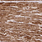 Immunohistochemical staining of human heart muscle shows strong cytoplasmic granular positivity in cardiomyocytes.