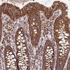 Immunohistochemical staining of human colon shows strong cytoplasmic granular positivity in glandular cells.