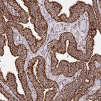 Immunohistochemical staining of human fallopian tube shows strong cytoplasmic granular positivity in glandular cells.