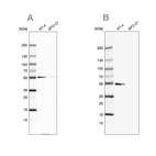 Anti-ATP5A1 Antibody