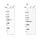Western blot analysis using Anti-ATP5A1 antibody HPA044202 (A) shows similar pattern to independent antibody HPA040622 (B).