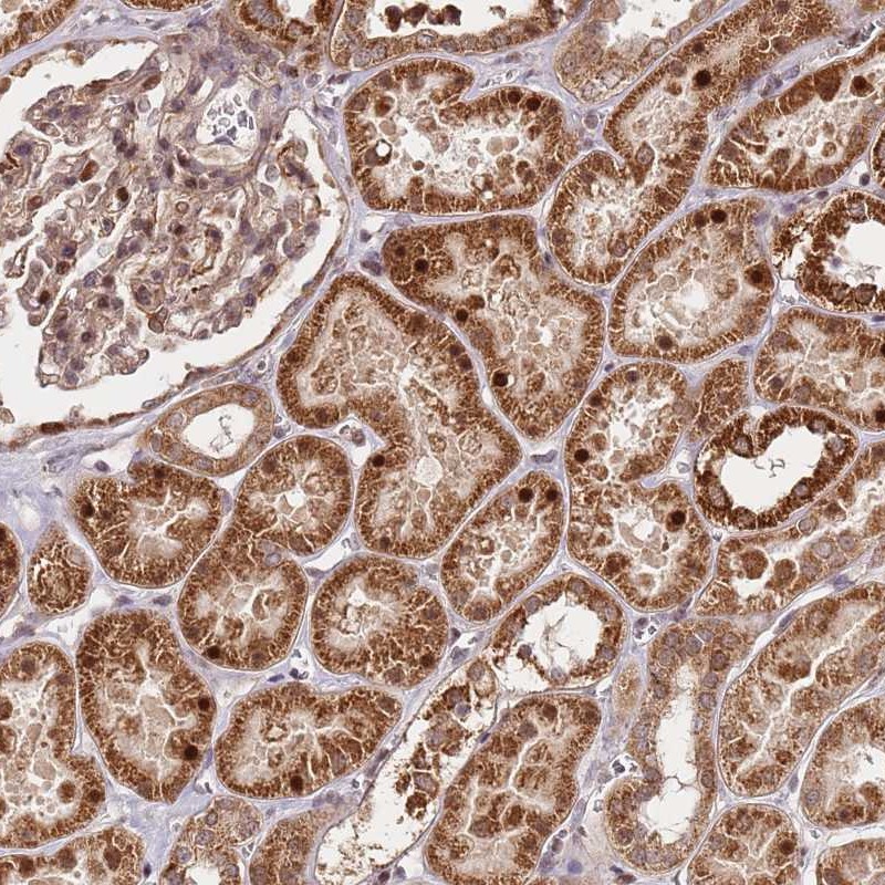 Anti-EDC3 Antibody