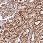 Anti-EDC3 Antibody