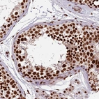 Immunohistochemical staining of human Testis shows strong nuclear positivity in cells in seminiferous ducts.