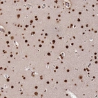 Immunohistochemical staining of human Cerebral cortex shows strong nuclear positivity in neuronal and glial cells.