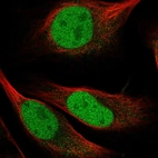 Immunofluorescent staining of human cell line U-2 OS shows localization to nucleoplasm.