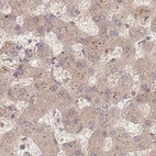 Immunohistochemical staining of human liver using Anti-PSMD9 antibody HPA044220.