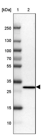 Lane 1: Marker [kDa] 250, 130, 100, 70, 55, 35, 25, 15, 10_br/_Lane 2: Human cell line MCF-7