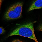 Immunofluorescent staining of human cell line U-2 OS shows localization to cytosol.
