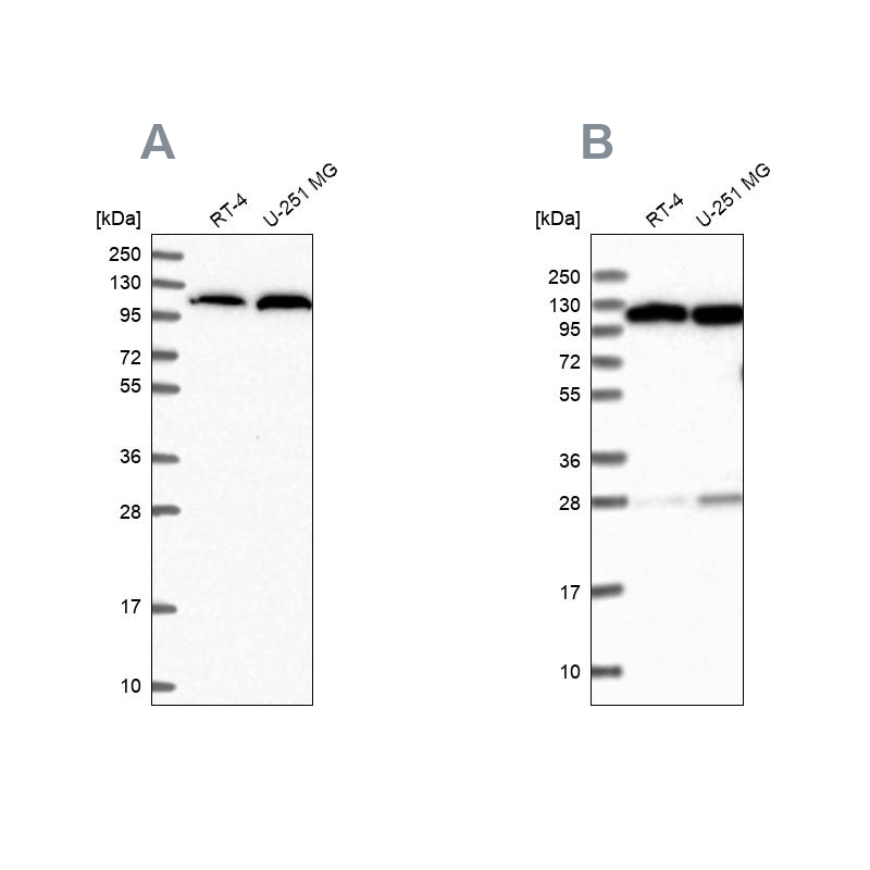 Anti-AARS Antibody