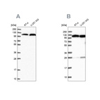 Anti-AARS Antibody