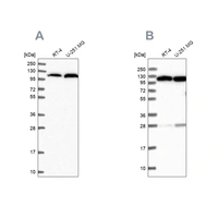 Anti-AARS Antibody
