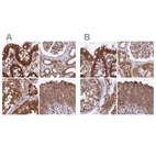 Anti-MKKS Antibody