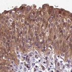 Immunohistochemical staining of human urinary bladder using Anti-MKKS antibody HPA044233.