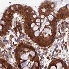 Immunohistochemical staining of human colon using Anti-MKKS antibody HPA044233.