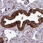 Immunohistochemical staining of human fallopian tube shows strong to very strong granular cytoplasmic positivity in glandular cells.