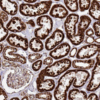 Immunohistochemical staining of human kidney shows strong to very strong granular cytoplasmic positivity in cells in tubules.