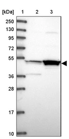 Lane 1: Marker [kDa] 250, 130, 95, 72, 55, 36, 28, 17, 10_br/_Lane 2: Human cell line RT-4_br/_Lane 3: Human cell line U-251MG sp