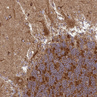 Immunohistochemical staining of human cerebellum shows moderate to strong granular cytoplasmic positivity in Purkinje cells.
