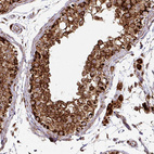 Immunohistochemical staining of human testis shows moderate to strong granular cytoplasmic positivity in seminiferous ducts.