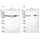 Western blot analysis using Anti-TRAP1 antibody HPA044227 (A) shows similar pattern to independent antibody HPA041082 (B).