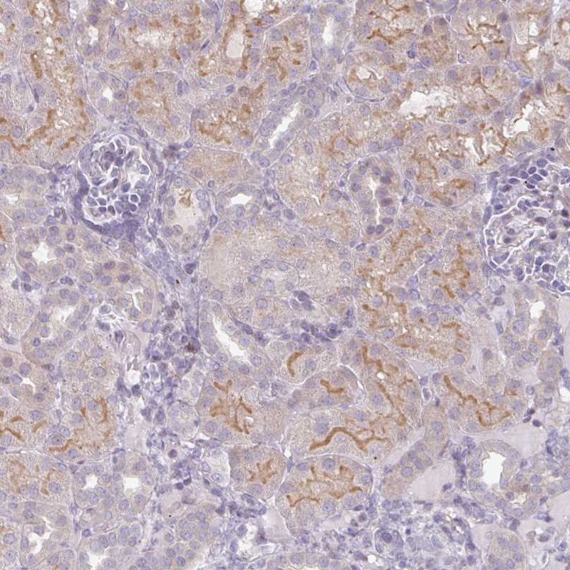 Anti-WFIKKN1 Antibody