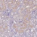 Anti-WFIKKN1 Antibody