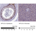 Anti-SPTLC3 Antibody