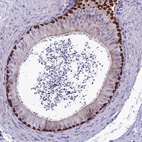 Immunohistochemical staining of human epididymis shows high expression.