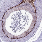 Immunohistochemical staining of human epididymis shows high expression.
